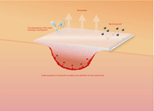 Krusse Foam Sterile Dressing (15x15cm)